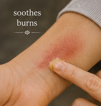 Close-up of a person's forearm with a red burn mark and a finger touching the area, with Meadowlake Farm Wound Salve being applied with the text 'sothes burns' overlaid on the image.