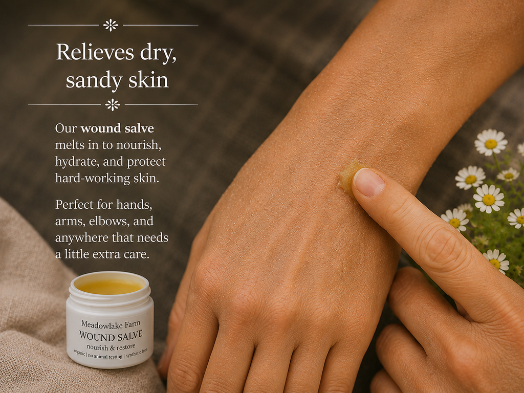 A close-up of a hand applying a small amount of  to another hMeadowlake Farm Wound Salve and, with text on the left reading 'Relieves dry, sandy skin' and a small jar of Mendota Lake Farm Wound Salve shown at the bottom left.