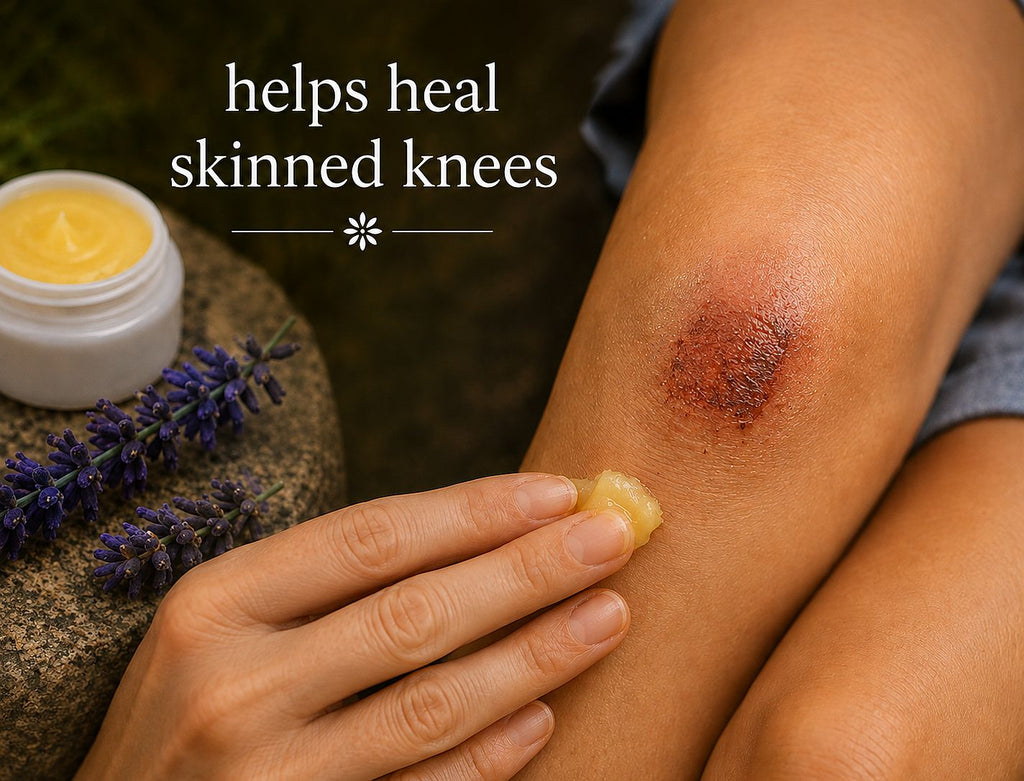 A close-up of a person applying a yellow  to a rMeadowlake Farm Wound Salve to a child's red, irritated knee, with text reading 'helps heal skinned knees' and a small jar of the cream and lavender sprigs nearby.